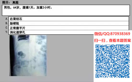 图片[80]颐考教育-医考必过吧临床专业实践技能机考真题颐考教育-医考必过吧颐考教育-医考必过吧