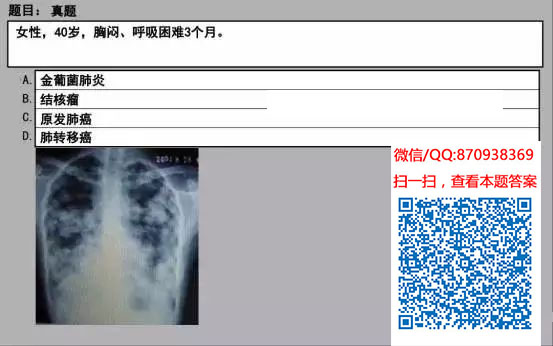 图片[79]颐考教育-医考必过吧临床专业实践技能机考真题颐考教育-医考必过吧颐考教育-医考必过吧