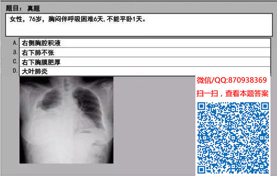 图片[74]颐考教育-医考必过吧临床专业实践技能机考真题颐考教育-医考必过吧颐考教育-医考必过吧