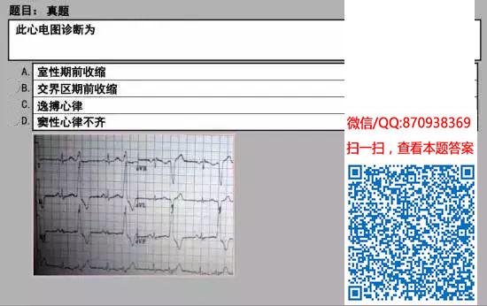 图片[66]颐考教育-医考必过吧临床专业实践技能机考真题颐考教育-医考必过吧颐考教育-医考必过吧