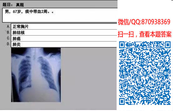 图片[69]颐考教育-医考必过吧临床专业实践技能机考真题颐考教育-医考必过吧颐考教育-医考必过吧