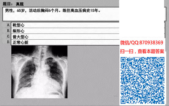 图片[70]颐考教育-医考必过吧临床专业实践技能机考真题颐考教育-医考必过吧颐考教育-医考必过吧