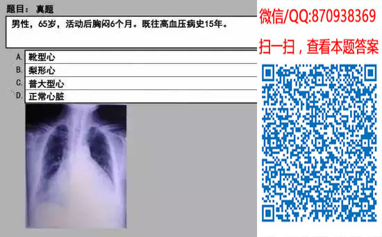 图片[64]颐考教育-医考必过吧临床专业实践技能机考真题颐考教育-医考必过吧颐考教育-医考必过吧