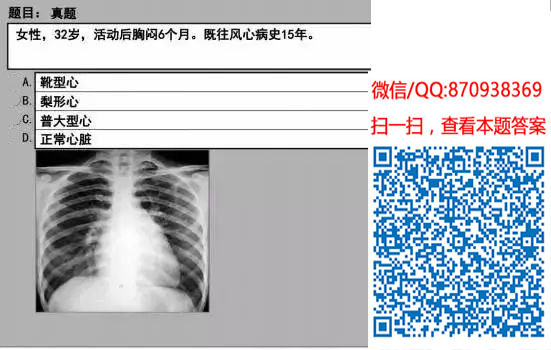 图片[65]颐考教育-医考必过吧临床专业实践技能机考真题颐考教育-医考必过吧颐考教育-医考必过吧
