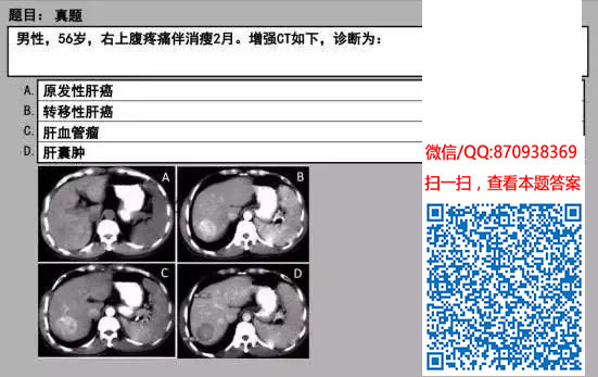 图片[62]颐考教育-医考必过吧临床专业实践技能机考真题颐考教育-医考必过吧颐考教育-医考必过吧