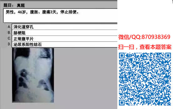 图片[61]颐考教育-医考必过吧临床专业实践技能机考真题颐考教育-医考必过吧颐考教育-医考必过吧