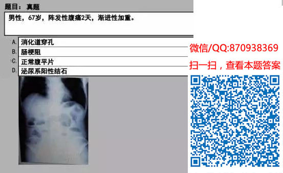 图片[58]颐考教育-医考必过吧临床专业实践技能机考真题颐考教育-医考必过吧颐考教育-医考必过吧