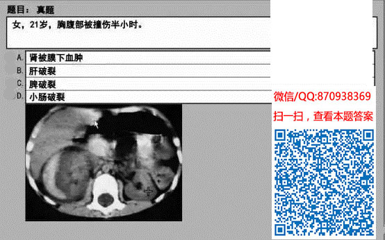 图片[54]颐考教育-医考必过吧临床专业实践技能机考真题颐考教育-医考必过吧颐考教育-医考必过吧