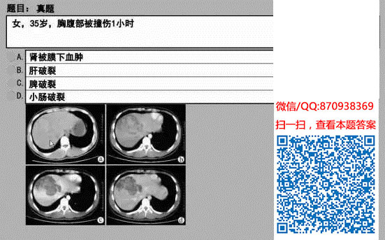 图片[55]颐考教育-医考必过吧临床专业实践技能机考真题颐考教育-医考必过吧颐考教育-医考必过吧
