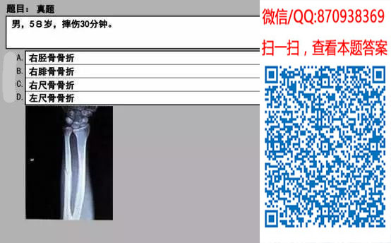 图片[46]颐考教育-医考必过吧临床专业实践技能机考真题颐考教育-医考必过吧颐考教育-医考必过吧