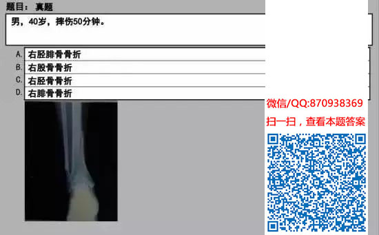 图片[48]颐考教育-医考必过吧临床专业实践技能机考真题颐考教育-医考必过吧颐考教育-医考必过吧