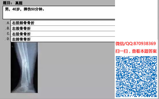 图片[47]颐考教育-医考必过吧临床专业实践技能机考真题颐考教育-医考必过吧颐考教育-医考必过吧