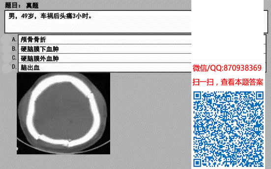 图片[49]颐考教育-医考必过吧临床专业实践技能机考真题颐考教育-医考必过吧颐考教育-医考必过吧