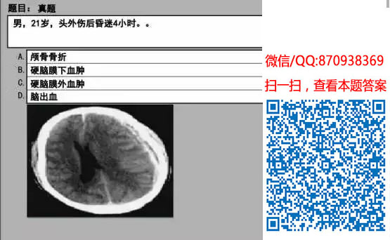 图片[44]颐考教育-医考必过吧临床专业实践技能机考真题颐考教育-医考必过吧颐考教育-医考必过吧