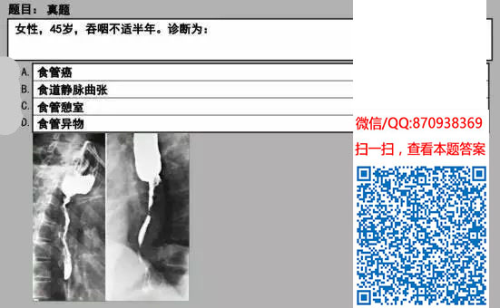 图片[41]颐考教育-医考必过吧临床专业实践技能机考真题颐考教育-医考必过吧颐考教育-医考必过吧