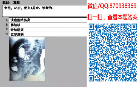 图片[38]颐考教育-医考必过吧临床专业实践技能机考真题颐考教育-医考必过吧颐考教育-医考必过吧
