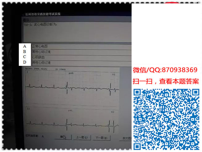图片[34]颐考教育-医考必过吧临床专业实践技能机考真题颐考教育-医考必过吧颐考教育-医考必过吧
