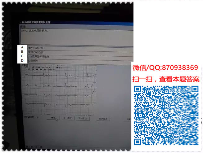 图片[35]颐考教育-医考必过吧临床专业实践技能机考真题颐考教育-医考必过吧颐考教育-医考必过吧