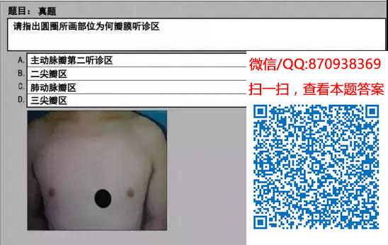 图片[95]颐考教育-医考必过吧临床专业实践技能机考真题颐考教育-医考必过吧颐考教育-医考必过吧
