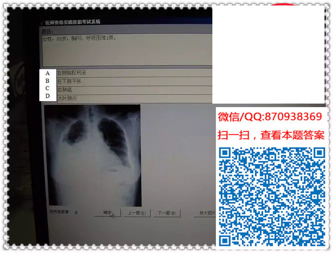 图片[22]颐考教育-医考必过吧临床专业实践技能机考真题颐考教育-医考必过吧颐考教育-医考必过吧