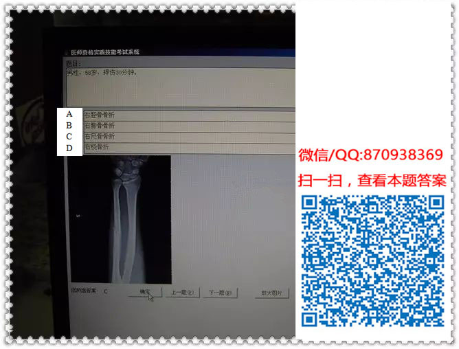 图片[21]颐考教育-医考必过吧临床专业实践技能机考真题颐考教育-医考必过吧颐考教育-医考必过吧