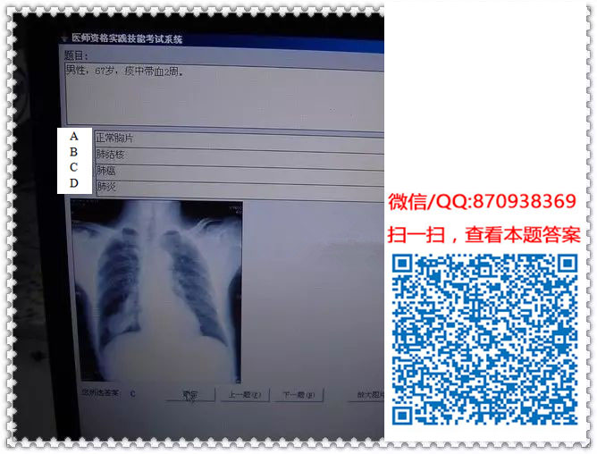 图片[16]颐考教育-医考必过吧临床专业实践技能机考真题颐考教育-医考必过吧颐考教育-医考必过吧