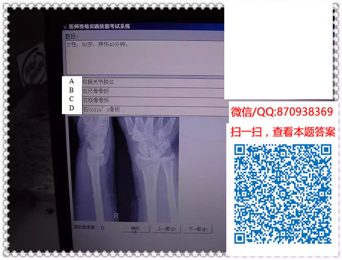 图片[18]颐考教育-医考必过吧临床专业实践技能机考真题颐考教育-医考必过吧颐考教育-医考必过吧