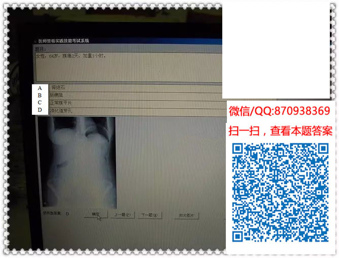 图片[17]颐考教育-医考必过吧临床专业实践技能机考真题颐考教育-医考必过吧颐考教育-医考必过吧