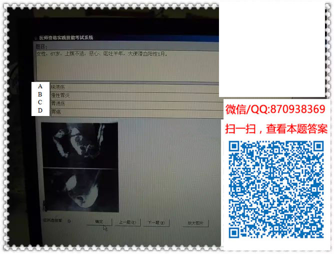 图片[19]颐考教育-医考必过吧临床专业实践技能机考真题颐考教育-医考必过吧颐考教育-医考必过吧