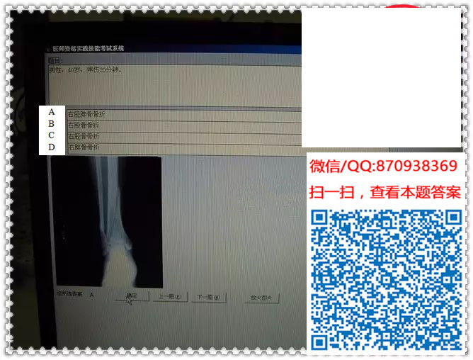 图片[15]颐考教育-医考必过吧临床专业实践技能机考真题颐考教育-医考必过吧颐考教育-医考必过吧