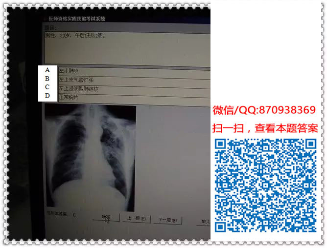 图片[20]颐考教育-医考必过吧临床专业实践技能机考真题颐考教育-医考必过吧颐考教育-医考必过吧
