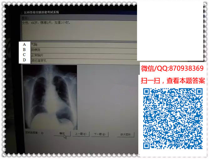 图片[13]颐考教育-医考必过吧临床专业实践技能机考真题颐考教育-医考必过吧颐考教育-医考必过吧
