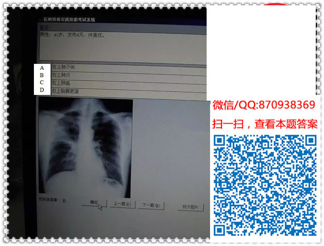 图片[14]颐考教育-医考必过吧临床专业实践技能机考真题颐考教育-医考必过吧颐考教育-医考必过吧