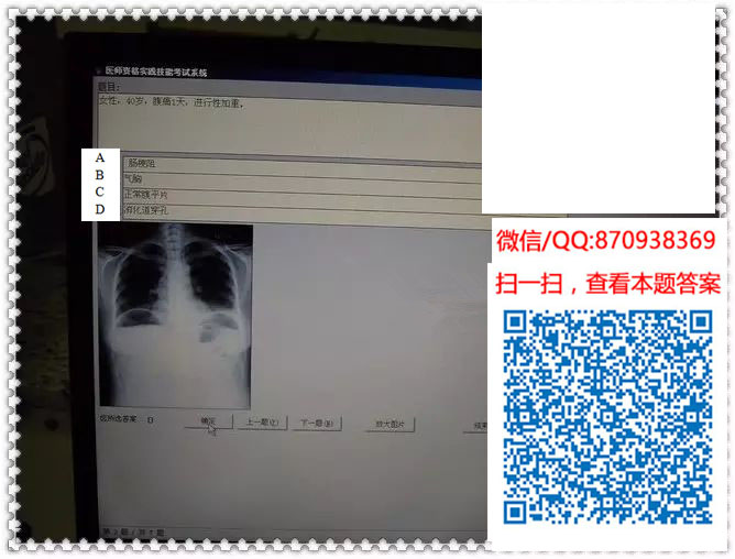 图片[11]颐考教育-医考必过吧临床专业实践技能机考真题颐考教育-医考必过吧颐考教育-医考必过吧