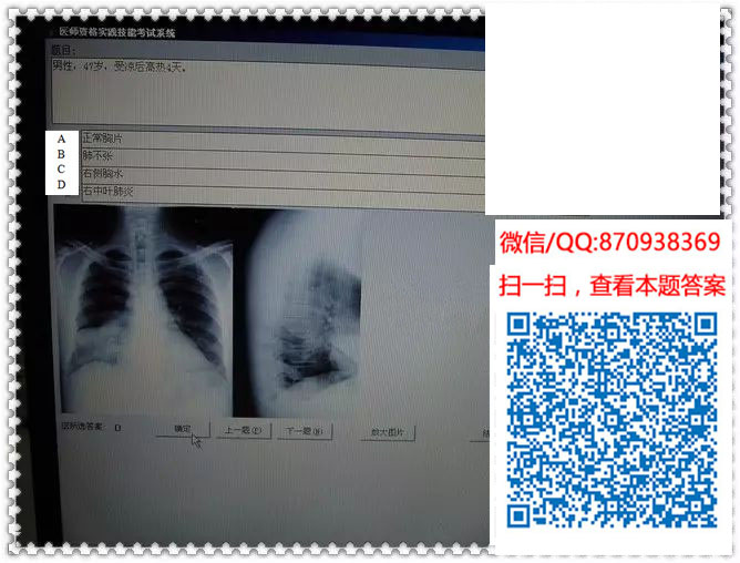 图片[12]颐考教育-医考必过吧临床专业实践技能机考真题颐考教育-医考必过吧颐考教育-医考必过吧