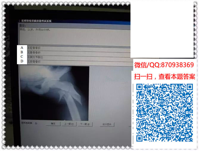 图片[8]颐考教育-医考必过吧临床专业实践技能机考真题颐考教育-医考必过吧颐考教育-医考必过吧