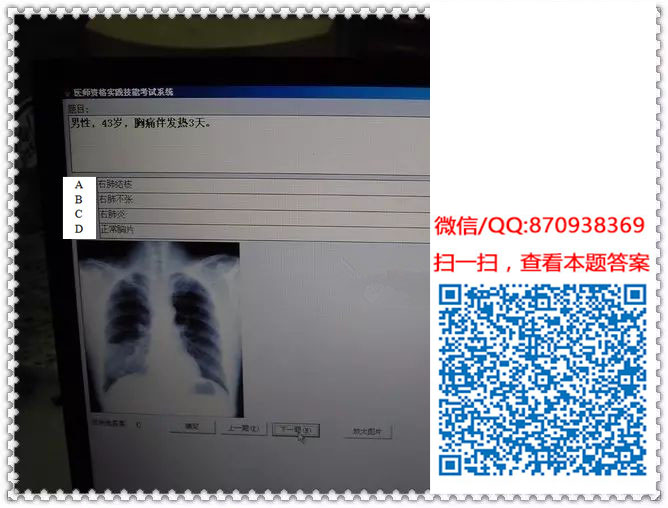 图片[10]颐考教育-医考必过吧临床专业实践技能机考真题颐考教育-医考必过吧颐考教育-医考必过吧