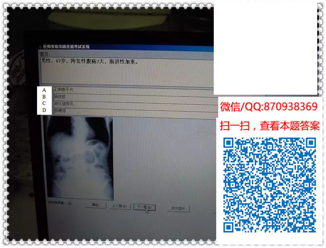 图片[6]颐考教育-医考必过吧临床专业实践技能机考真题颐考教育-医考必过吧颐考教育-医考必过吧