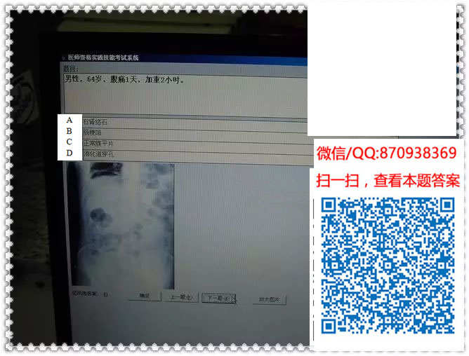 图片[4]颐考教育-医考必过吧临床专业实践技能机考真题颐考教育-医考必过吧颐考教育-医考必过吧