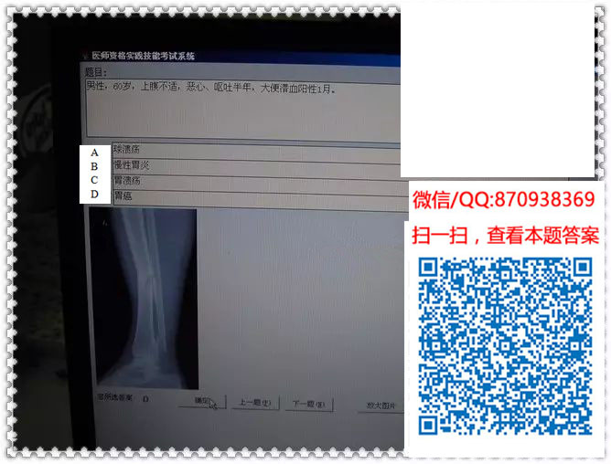 图片[5]颐考教育-医考必过吧临床专业实践技能机考真题颐考教育-医考必过吧颐考教育-医考必过吧