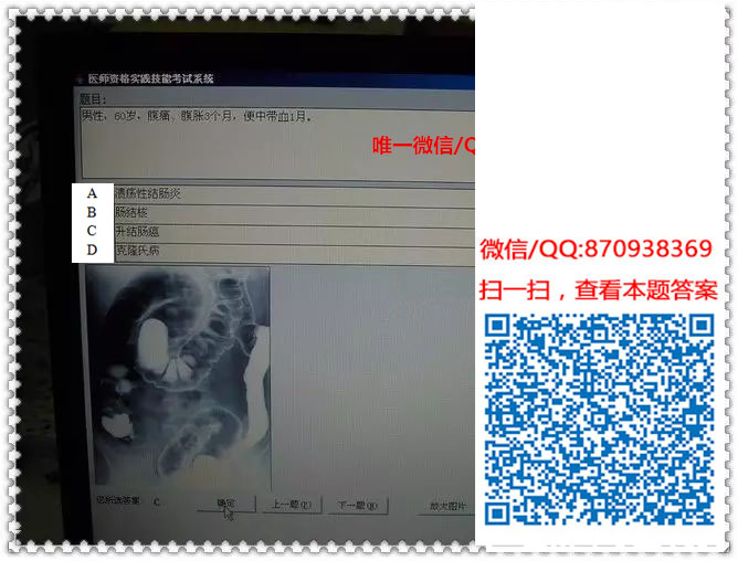 图片[2]颐考教育-医考必过吧临床专业实践技能机考真题颐考教育-医考必过吧颐考教育-医考必过吧