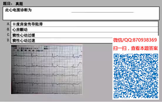 图片[76]颐考教育-医考必过吧临床专业实践技能机考真题颐考教育-医考必过吧颐考教育-医考必过吧