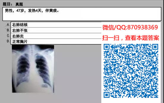 图片[91]颐考教育-医考必过吧临床专业实践技能机考真题颐考教育-医考必过吧颐考教育-医考必过吧