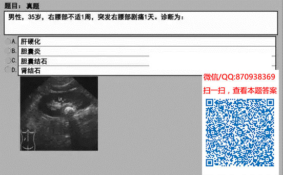 图片[86]颐考教育-医考必过吧临床专业实践技能机考真题颐考教育-医考必过吧颐考教育-医考必过吧