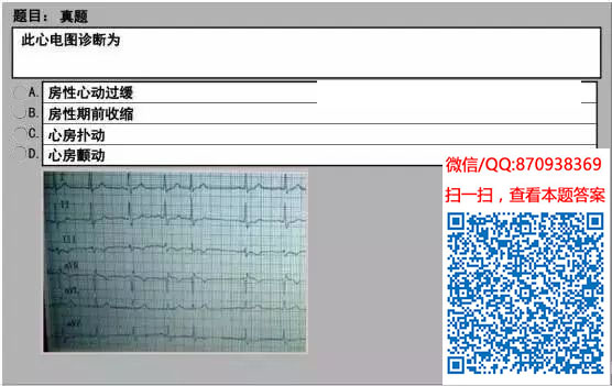 图片[89]颐考教育-医考必过吧临床专业实践技能机考真题颐考教育-医考必过吧颐考教育-医考必过吧